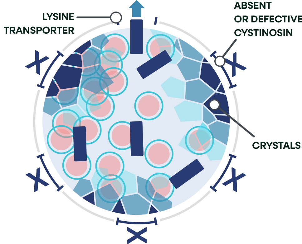 lysosome patient with cystnosys